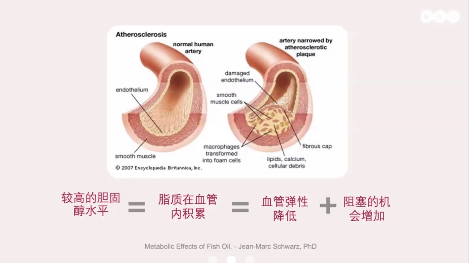 Artery Atherosclerosis Plaque Diagram